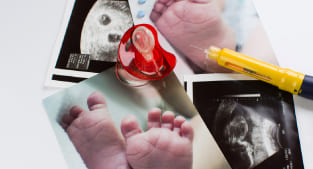 Ultrasound & Baby foot Prints - NU Fertility