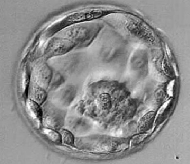 Blastocyst Embryo Transfer - NU Fertility