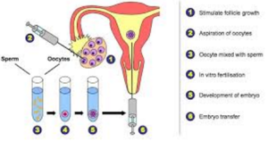 IVF Cycle