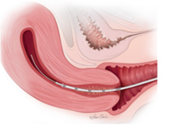 IVF Centre in Bangalore