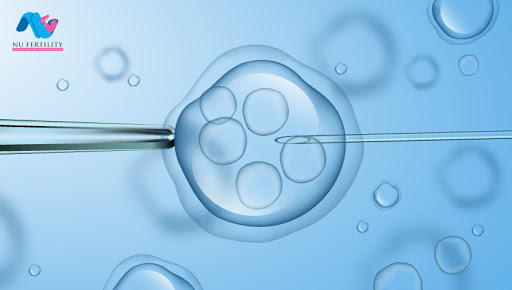 Brief History of In Vitro Fertilization