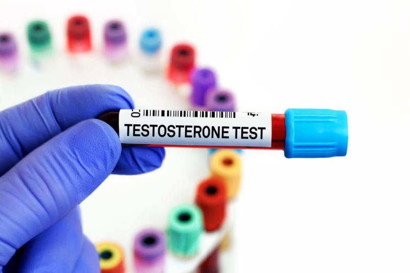 Blood Samples for Testosterone Test - NU Fertility