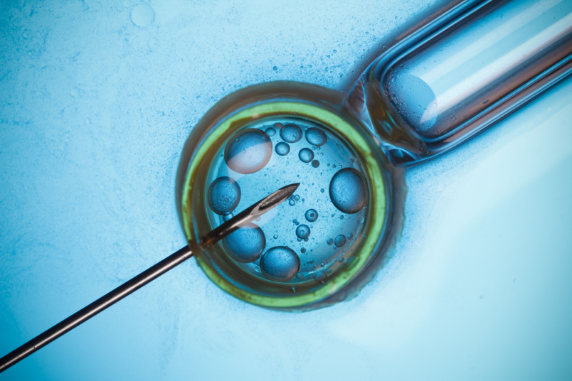 In Vitro Fertilization - NU Fertility