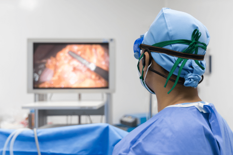Surgeon Doing Laparoscopic Surgery - NU Fertility