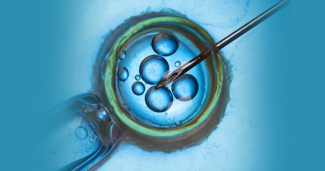 IVF Treatment in Bangalore - NU Fertility